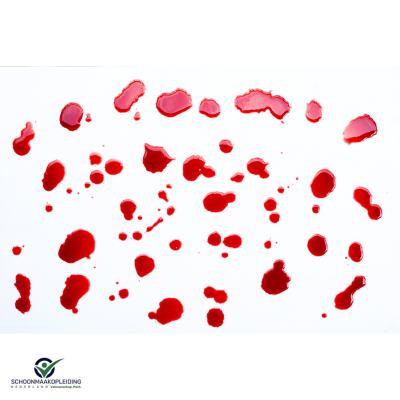 Training hoogrisico schoonmaak: bloed, fecaliën